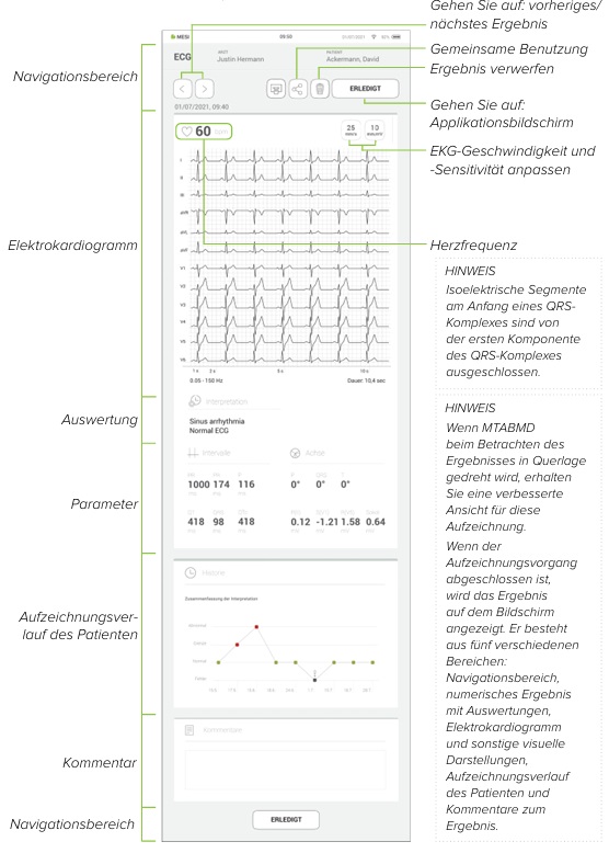 MESI mTABLET ECG-EKG ÜBERPRÜFUNG