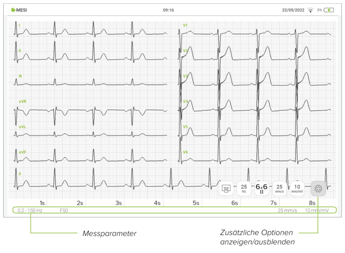 MESI mTABLET ECG-EKG ÜBERPRÜFUNG - 2