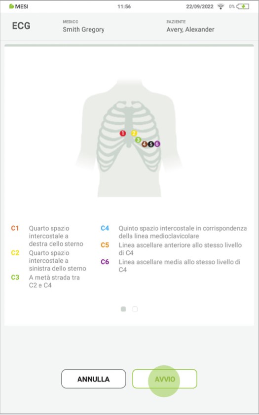 MESI mTABLET ECG-EFFETTUARE LA REGISTRAZIONE ECG - Fase 3