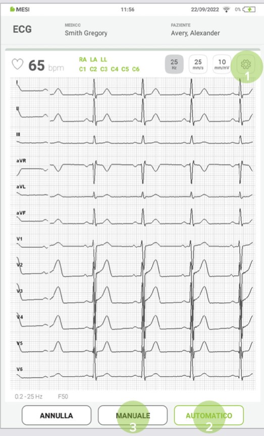 MESI mTABLET ECG-EFFETTUARE LA REGISTRAZIONE ECG - Fase 5