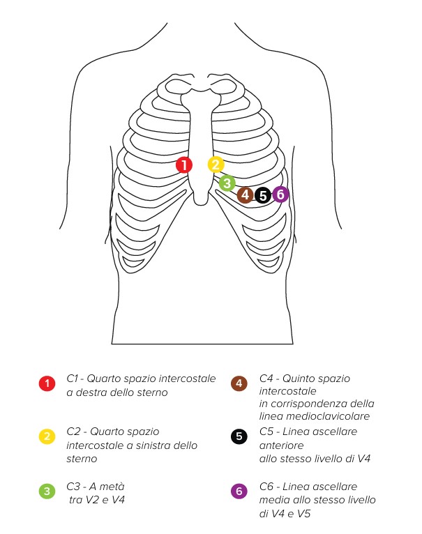 MESI mTABLET ECG-POSIZIONAMENTO DELL'ELETTRODO 02