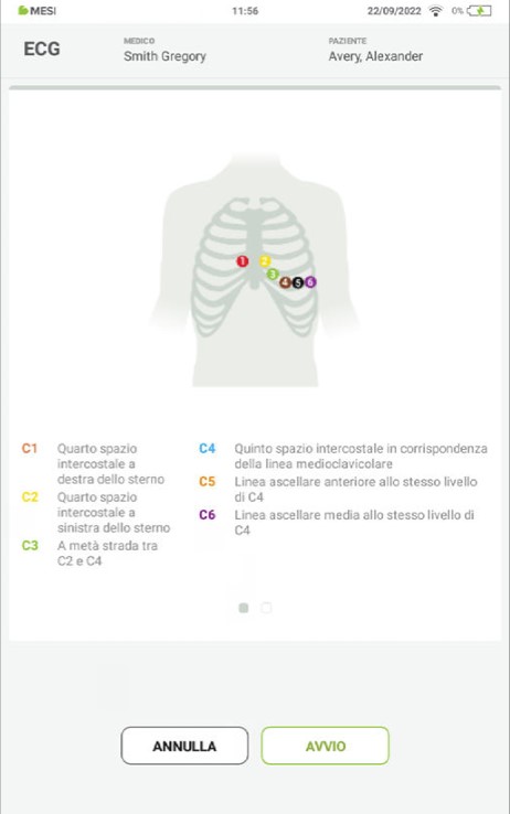 MESI mTABLET ECG-REGISTRARE L'ECG- Fase 3