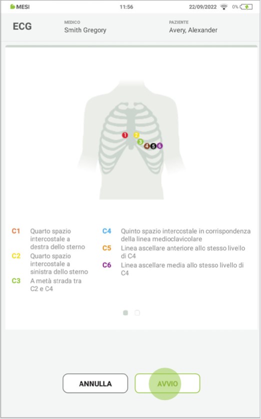 MESI mTABLET ECG-REGISTRARE L'ECG- Fase 6