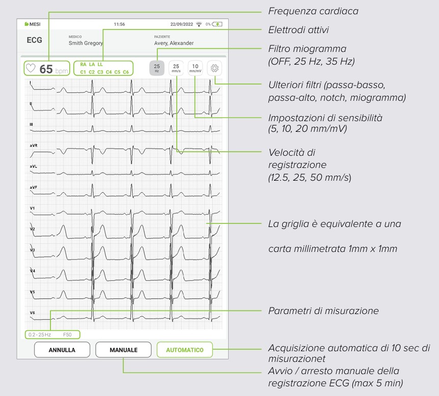 MESI mTABLET ECG-REGISTRARE L'ECG- Fase 7