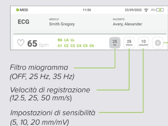 MESI mTABLET ECG-REGISTRARE L'ECG- Fase 8