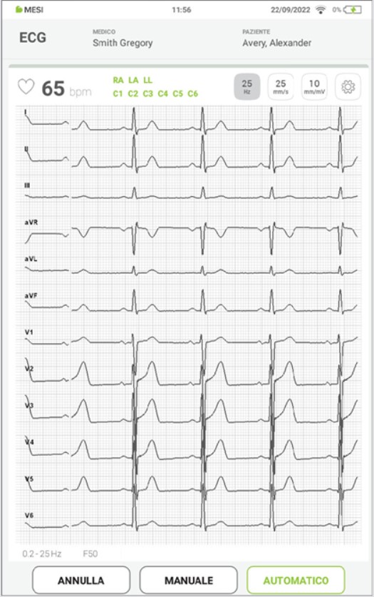 MESI mTABLET ECG-REGISTRARE L'ECG- Fase 10