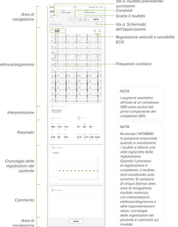 MESI mTABLET ECG-ESAME DELL'ECG