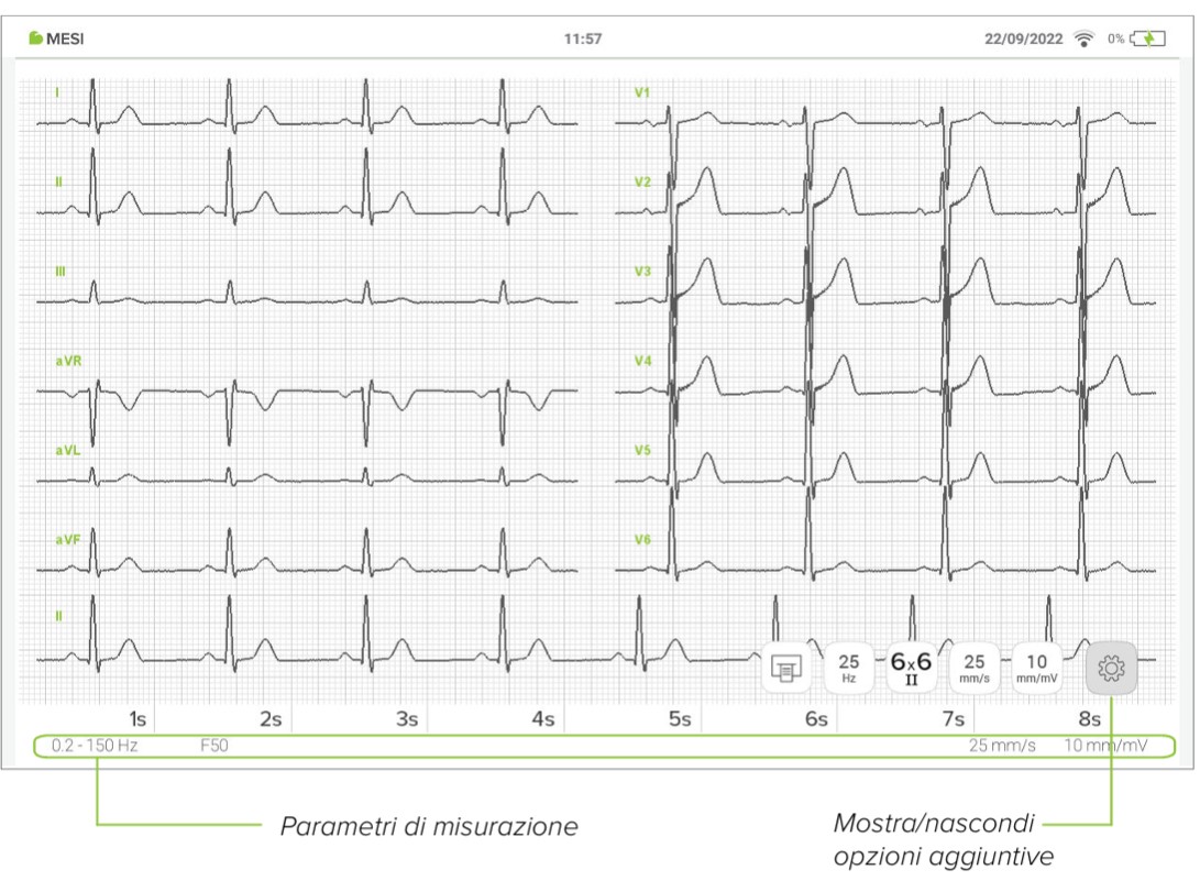 MESI mTABLET ECG-ESAME DELL'ECG 02