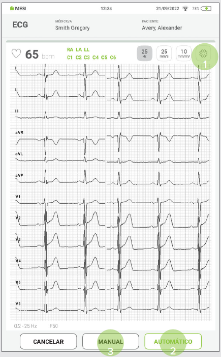 MESI mTABLET ECG - PERFORMING ECG RECORDING - Step 4,5