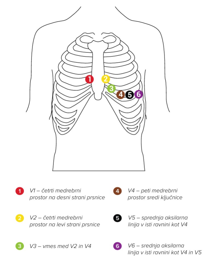MESI mTABLET ECG-NAMESTITEV ELEKTROD 02