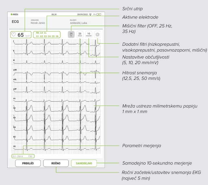 MESI mTABLET ECG-SNEMANJE EKG - Korak 7