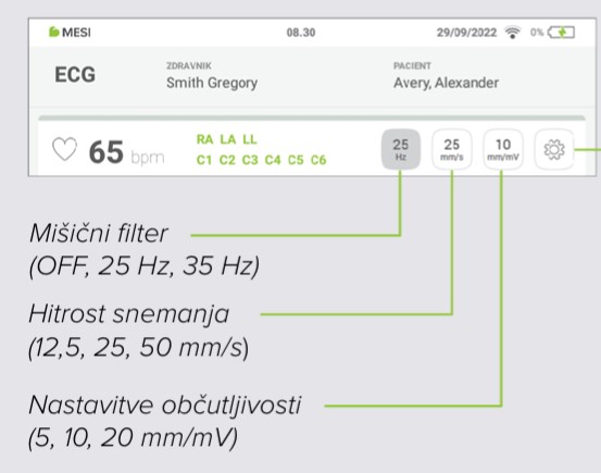 MESI mTABLET ECG-SNEMANJE EKG - Korak 8