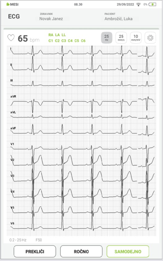 MESI mTABLET ECG-SNEMANJE EKG - Korak 10