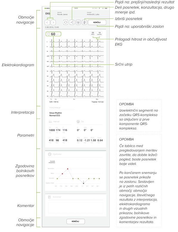 MESI mTABLET ECG-SNEMANJE V SAMODEJNEM NAČINU