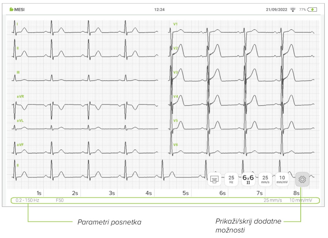 MESI mTABLET ECG-PREGLEDOVANJE EKG