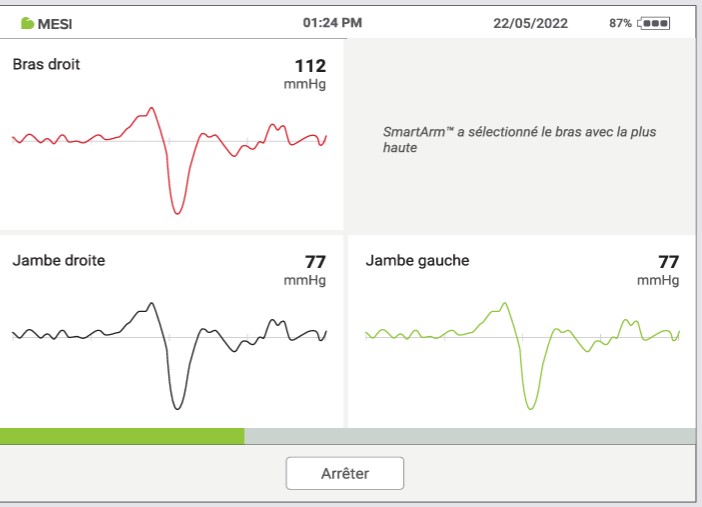 MESI ABPI MD V2-RÉALISER UNE MESURE DE L’IPS - Étape 2B