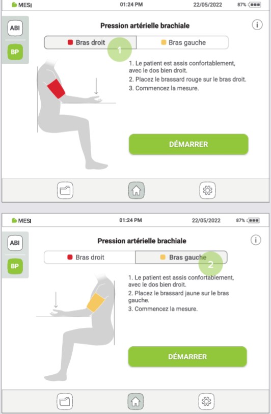 MESI ABPI MD V2-RÉALISER UNE MESURE DE PRESSION ARTÉRIELLE - Étape 1