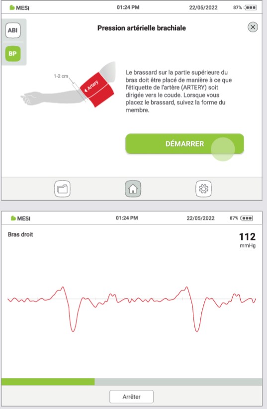 MESI ABPI MD V2-RÉALISER UNE MESURE DE PRESSION ARTÉRIELLE - Étape 2