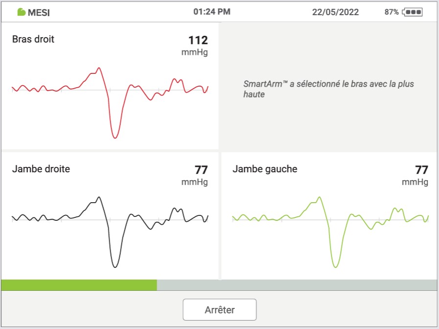 MESI ABPI MD V2-RÉALISER UNE MESURE DE L’IPS - Etape 4