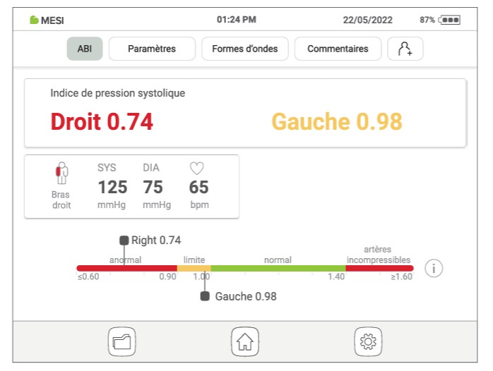 MESI ABPI MD V2-Valeurs IPS