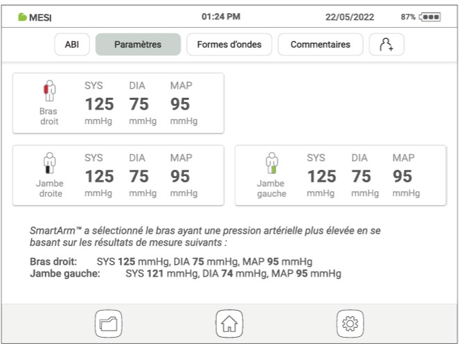 MESI ABPI MD V2-Paramètres
