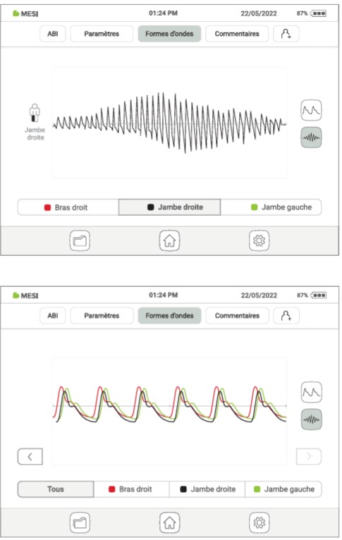 MESI ABPI MD V2-Ondes