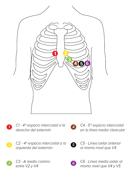 MESI mTABLET ECG - Electrode placement (2)