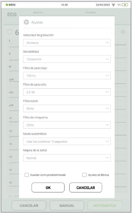 MESI mTABLET ECG - Recording the ecg - Step 9