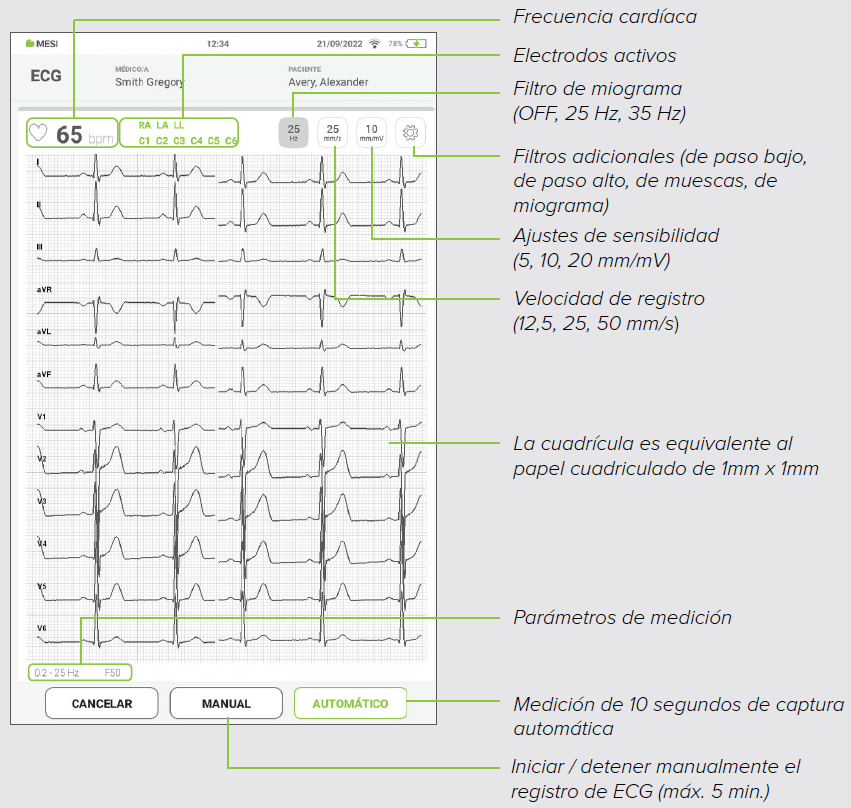MESI mTABLET ECG - Recording the ecg - Step 7