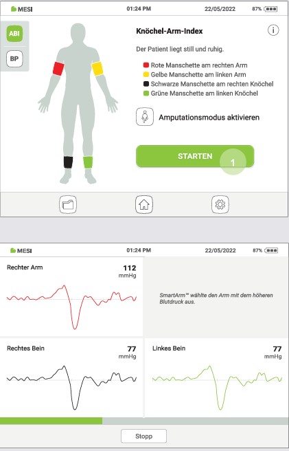 MESI ABPI MD V2-DURCHFÜHRUNG EINER ABIMESSUNG - Schritt 2