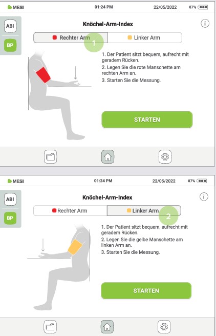 MESI ABPI MD V2-EINE BLUTDRUCK MESSUNG DURCHFÜHREN- Schritt 1