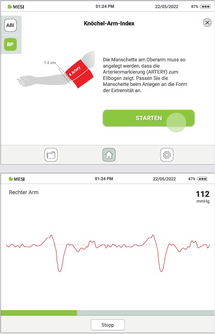 MESI ABPI MD V2-EINE BLUTDRUCK MESSUNG DURCHFÜHREN- Schritt 2