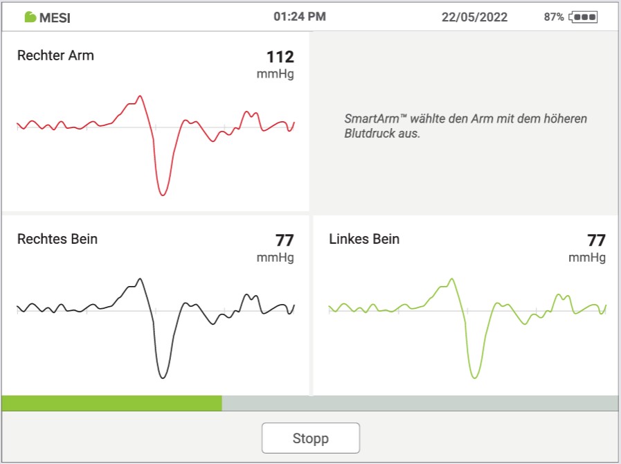 MESI ABPI MD V2 - DURCHFÜHRUNG EINER ABIMESSUNG - Schritt 4