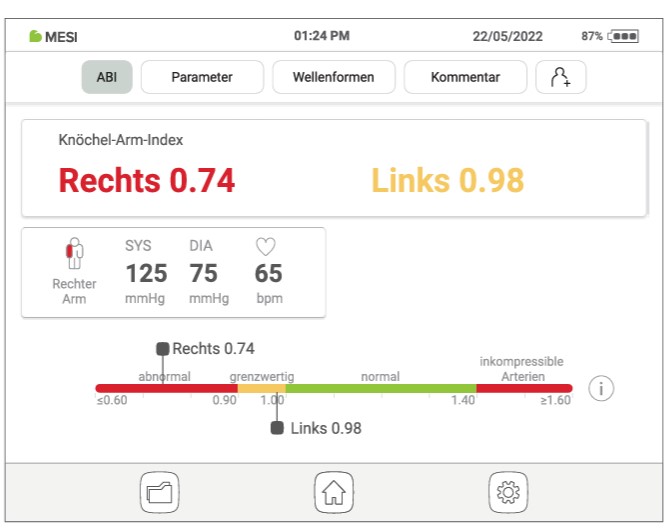 MESI ABPI MD V2 - ABI-Werte