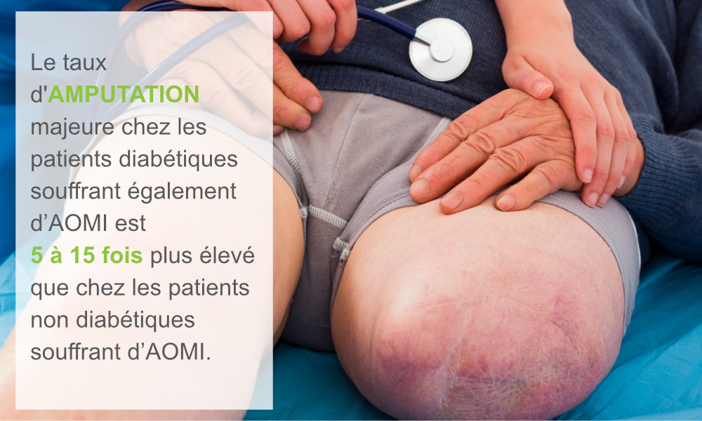 L’effet du diabète sur l’IPS -infographic