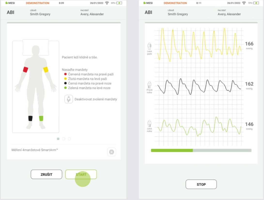 CZ - MESI mTABLET ABI - PROVEDENÍ MĚŘENÍ ABI - Step 4