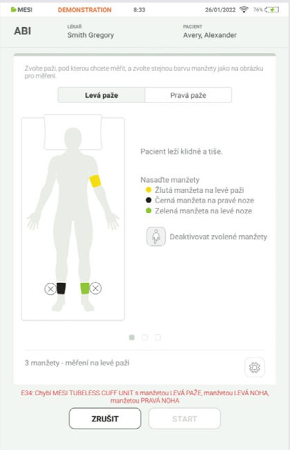 CZ - MESI mTABLET ABI -PROVEDENÍ MĚŘENÍ ABI - Step 4
