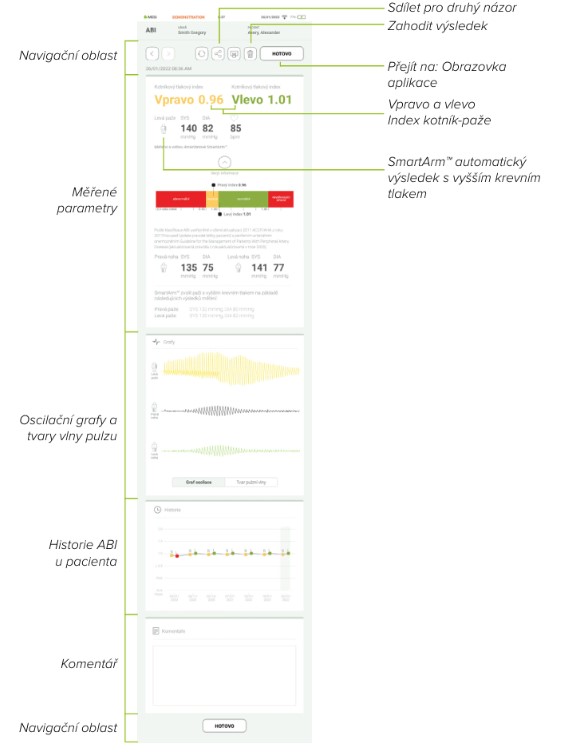 CZ - MESI mTABLET ABI -KONTROLA MĚŘENÍ AB