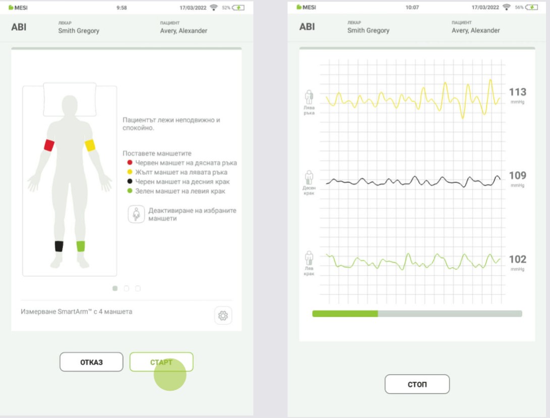 BG - MESI mTABLET ABI -ИЗМЕРВАНЕ НА ABI - Step 4