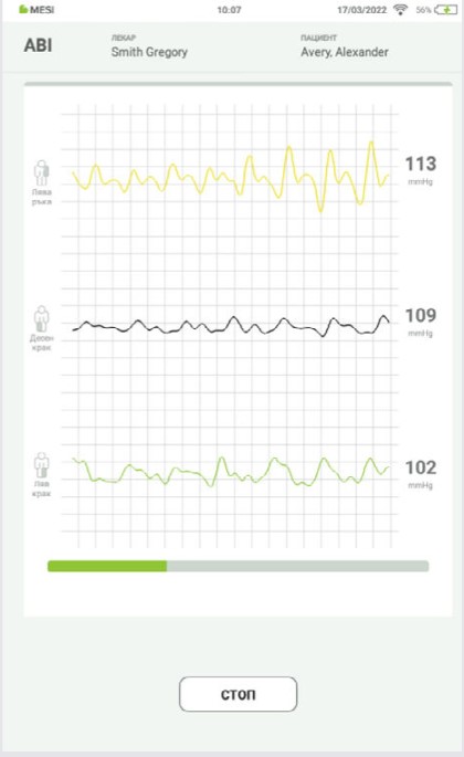 BG - MESI mTABLET ABI -ИЗМЕРВАНЕ НА ABI - Step 6