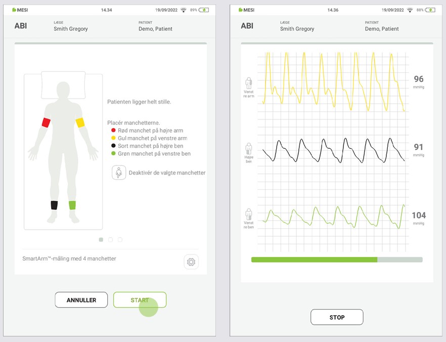 DA - MESI mTABLET ABI -UDFØRELSE AF ABI-MÅLING - Step 4