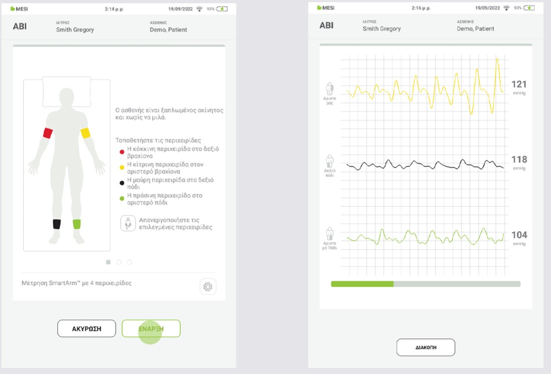 GR - MESI mTABLET ABI -ΕΚΤΕΛΕΣΗ ΜΕΤΡΗΣΗΣ ΑΒΙ - Step 4