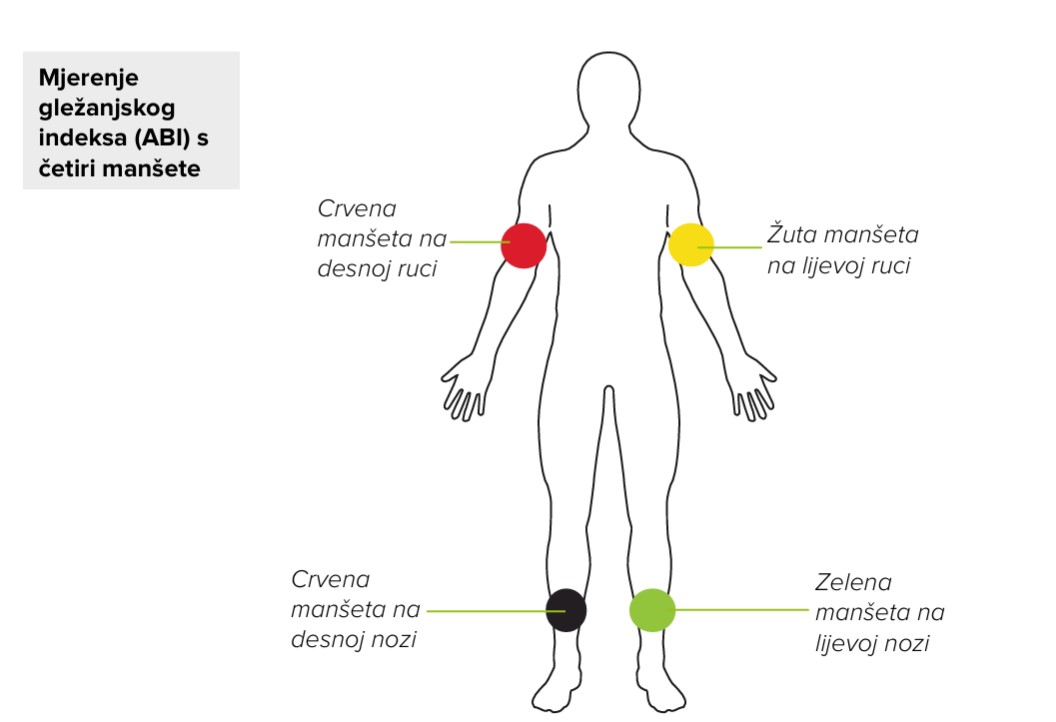 HR - MESI mTABLET ABI - POSTAVLJANJE MANŠETE