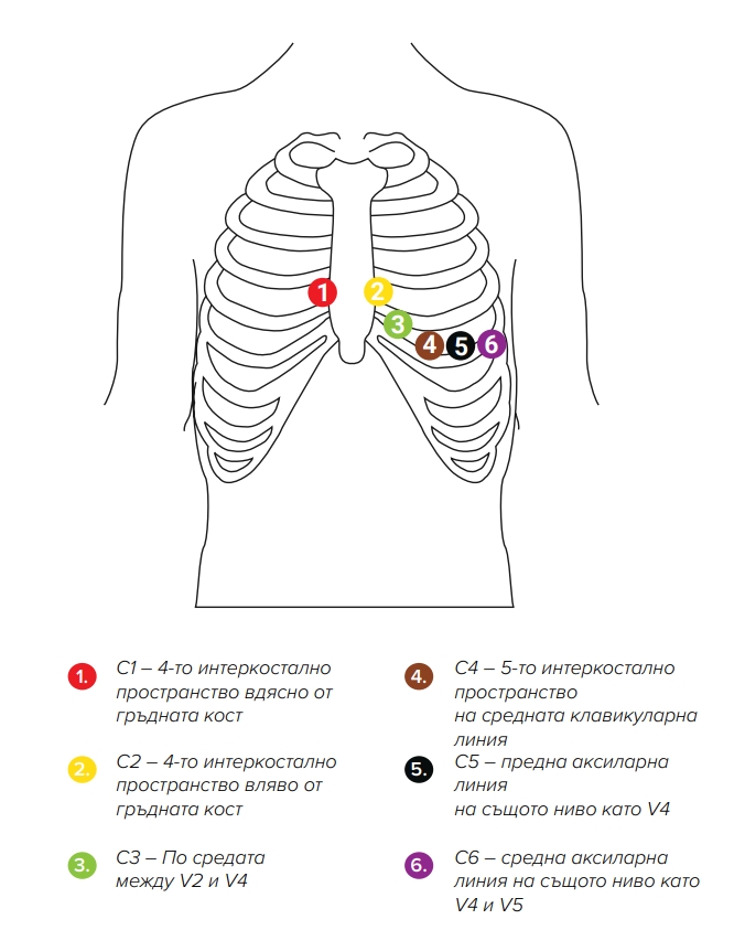 BG ECG instructions