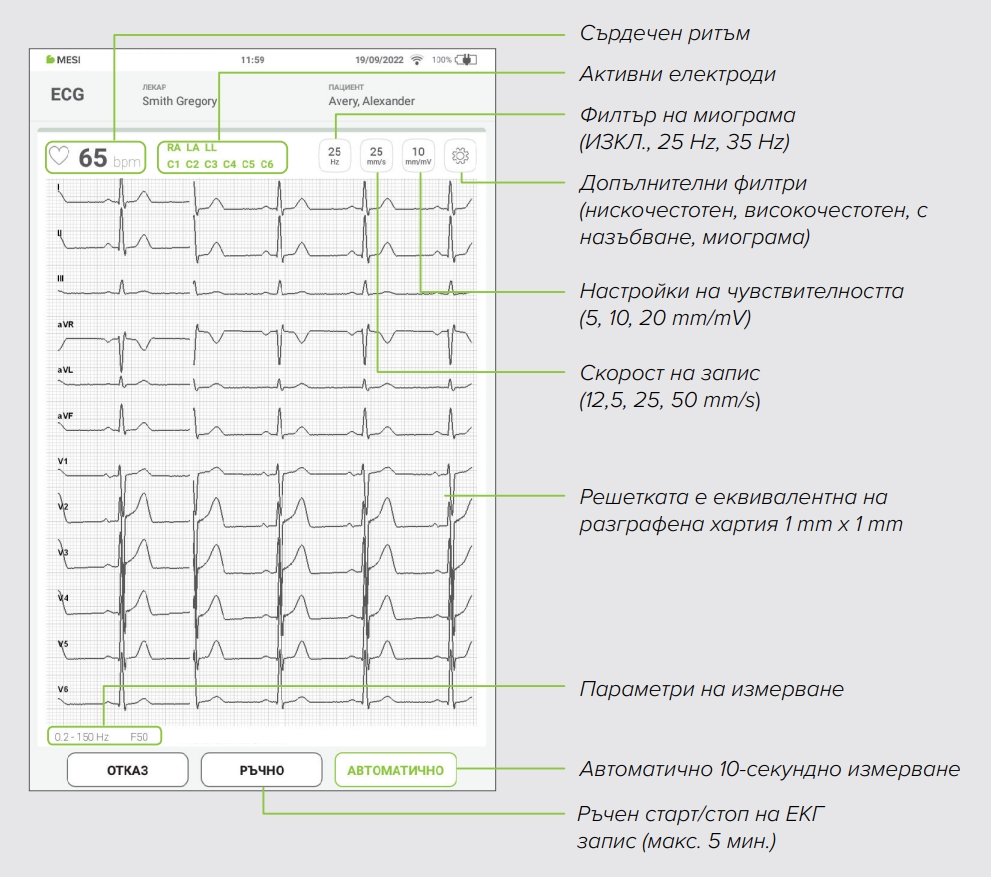 BG ECG recording