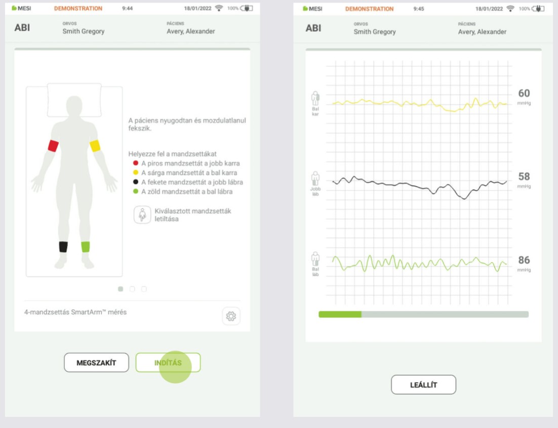 HU - MESI mTABLET ABI - AZ ABI MÉRÉS ELVÉGZÉSE - Step 4