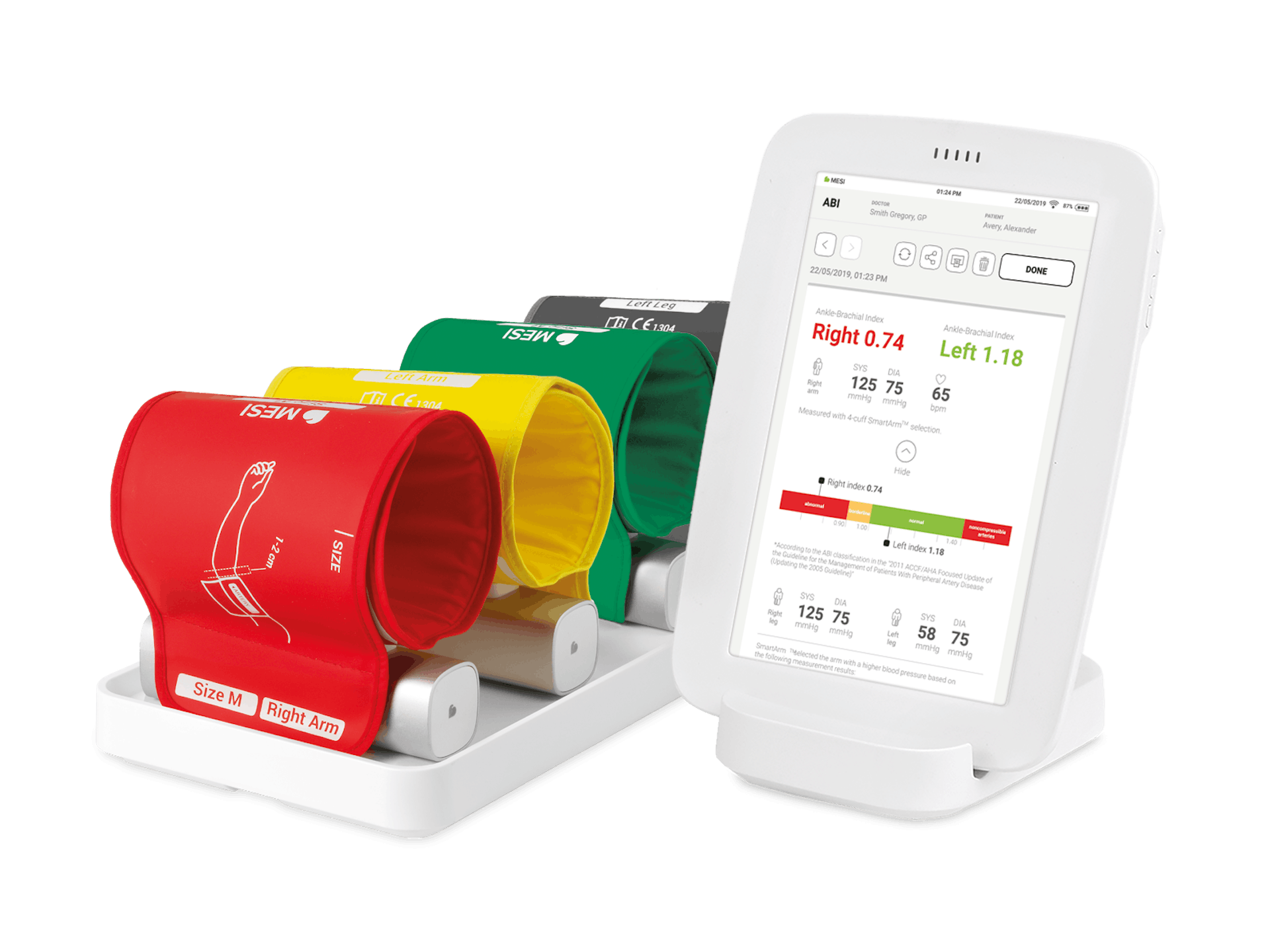 Ankle-Brachial Index