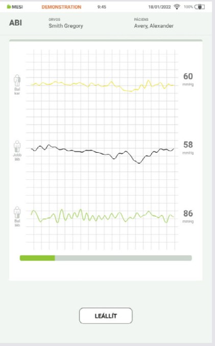HU - MESI mTABLET ABI -AZ ABI MÉRÉS ELVÉGZÉSE - Step 06