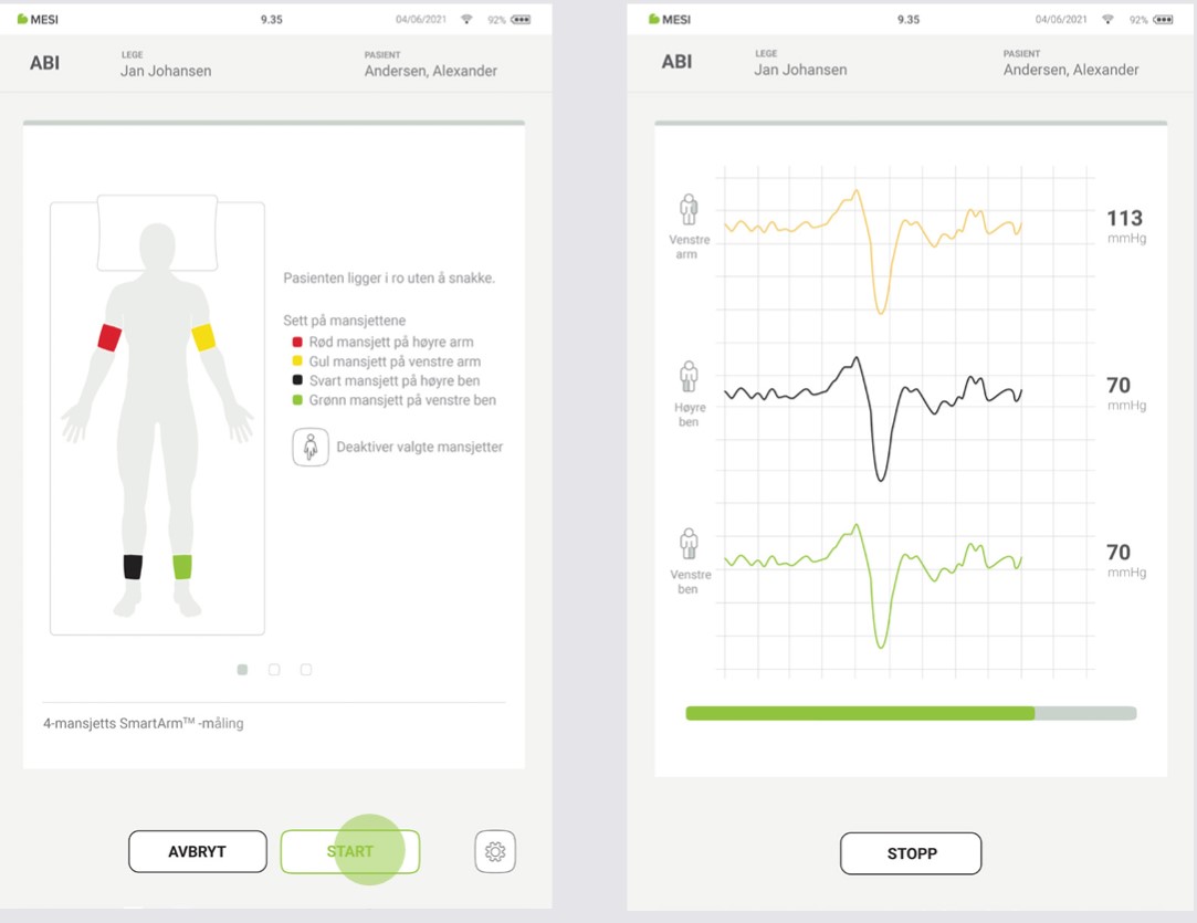 NO - MESI mTABLET ABI - UTFØRE ABIMÅLING - Step 4