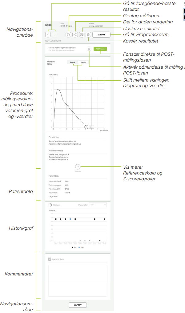MESI mTABLET SPIRO - Reviewing a spiro measurement